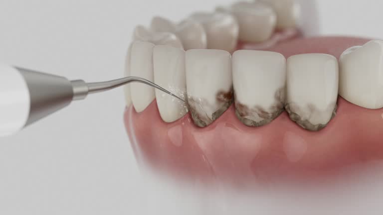 Trusted Tooth Extraction service in Buffalo, WY - Dentist Open Now